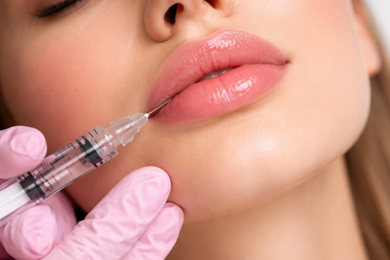 Unterspritzung Lippen Unterspritzung Lippen